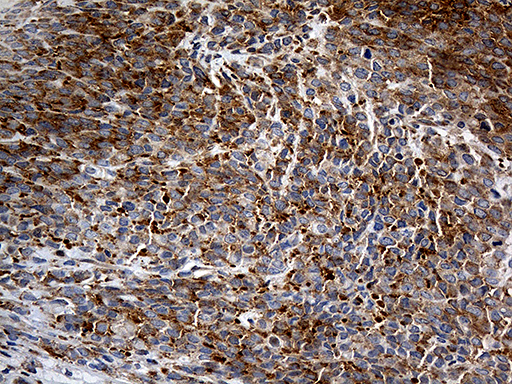 m06903 1 anti interleukin 34 il34 mouse monoclonal antibody clone id oti5e1 ihc testing 4