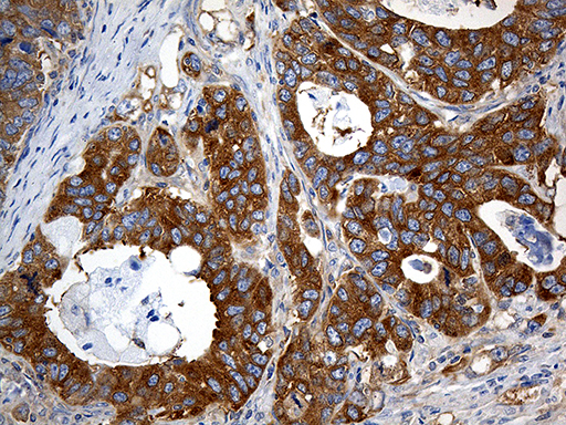 m06903 1 anti interleukin 34 il34 mouse monoclonal antibody clone id oti5e1 ihc testing 6