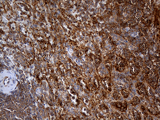 m06903 1 anti interleukin 34 il34 mouse monoclonal antibody clone id oti5e1 ihc testing 7