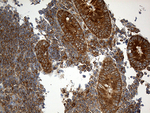 m06903 1 anti interleukin 34 il34 mouse monoclonal antibody clone id oti5e1 ihc testing 8