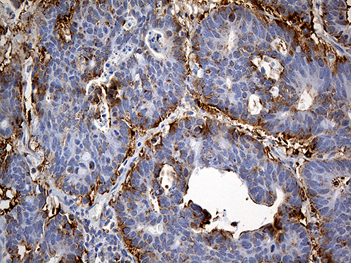 m06903 1 anti interleukin 34 il34 mouse monoclonal antibody clone id oti5e1 ihc testing 9