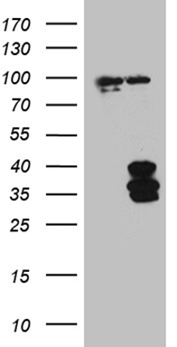 HEK293T cells were transfected with the pCMV6-ENTRY control (Left lane) or pCMV6-ENTRY IL34 (Right lane) cDNA for 48 hrs and lysed