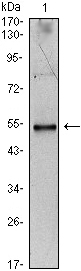 Western blotting validation for Anti-IL-34 Monoclonal Antibody M06903
Western Blot (WB) analysis using IL-34 Monoclonal Antibody against IL-34-hIgGFc transfected HEK293 cell lysate