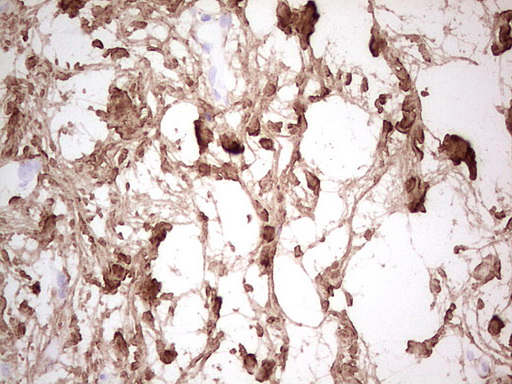 m06904 anti csnk1g1 mouse monoclonal antibody clone id oti4d9 ihc testing 4
