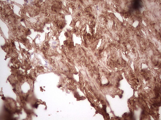m06904 anti csnk1g1 mouse monoclonal antibody clone id oti4d9 ihc testing 5