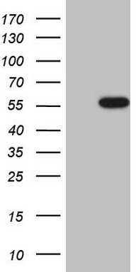 HEK293T cells were transfected with the pCMV6-ENTRY control (Left lane) or pCMV6-ENTRY CSNK1G1 (Right lane) cDNA for 48 hrs and lysed