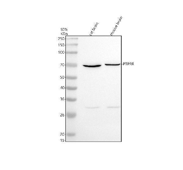 Western blot analysis of PTPRR using anti-PTPRR antibody (M06905)