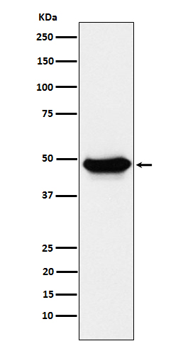 Western blot analysis of ENTPD5 expression in LnCaP cell lysate