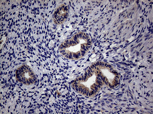 Immunohistochemical staining of paraffin-embedded Human endometrium tissue within the normal limits using anti-TRIP13 mouse monoclonal antibody