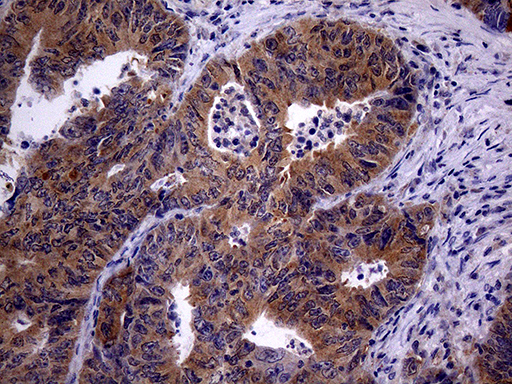 m06921 anti trip13 mouse monoclonal antibody clone id oti2f5 ihc testing 6