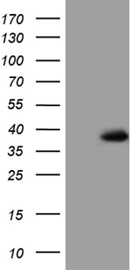 HEK293T cells were transfected with the pCMV6-ENTRY control (Left lane) or pCMV6-ENTRY TRIP13 (Right lane) cDNA for 48 hrs and lysed