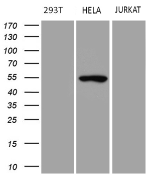 Western blot analysis of extracts (35ug) from 3 different cell lines by using anti-TRIP13 monoclonal antibody (293T: human; HeLa: human; Jurkat: human; ) (1:500)