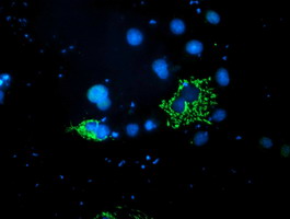 m06930 1 anti pdss2 mouse monoclonal antibody clone id oti1e9 if testing 6