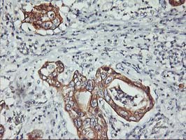 m06930 1 anti pdss2 mouse monoclonal antibody clone id oti1e9 ihc testing 2