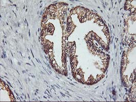 m06930 1 anti pdss2 mouse monoclonal antibody clone id oti1e9 ihc testing 3