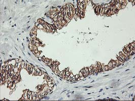 m06930 1 anti pdss2 mouse monoclonal antibody clone id oti1e9 ihc testing 4