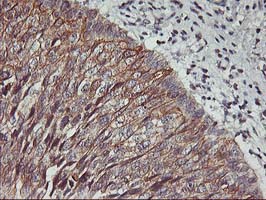 m06930 1 anti pdss2 mouse monoclonal antibody clone id oti1e9 ihc testing 5