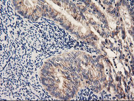 m06930 anti pdss2 mouse monoclonal antibody clone id oti1d12 ihc testing 4