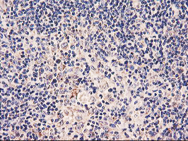 m06930 anti pdss2 mouse monoclonal antibody clone id oti1d12 ihc testing 5