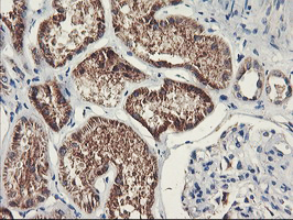 m06930 anti pdss2 mouse monoclonal antibody clone id oti1d12 ihc testing 6