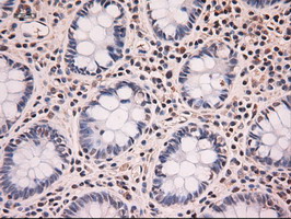 m06935 anti neurotrophin 4 ntf4 mouse monoclonal antibody clone id oti2e8 ihc testing 8