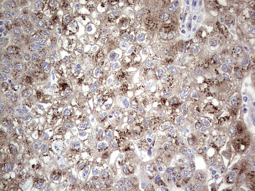 m06945 anti alkbh1 mouse monoclonal antibody clone id oti4c4 ihc testing 1