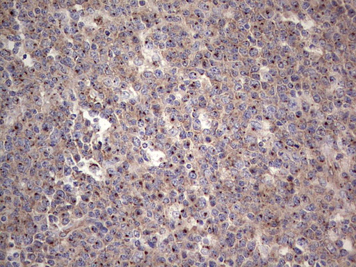 m06945 anti alkbh1 mouse monoclonal antibody clone id oti4c4 ihc testing 2