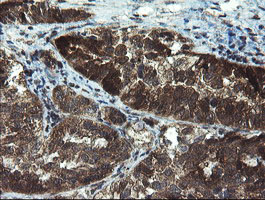 m06952 1 anti tbcc mouse monoclonal antibody clone id oti4c4 ihc testing 3