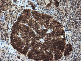m06952 1 anti tbcc mouse monoclonal antibody clone id oti4c4 ihc testing 4