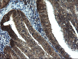 m06952 1 anti tbcc mouse monoclonal antibody clone id oti4c4 ihc testing 5