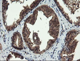 m06952 1 anti tbcc mouse monoclonal antibody clone id oti4c4 ihc testing 6