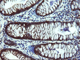 m06952 1 anti tbcc mouse monoclonal antibody clone id oti4c4 ihc testing 7