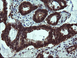 m06952 1 anti tbcc mouse monoclonal antibody clone id oti4c4 ihc testing 8