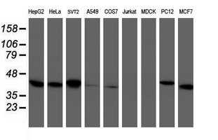 m06952 1 anti tbcc mouse monoclonal antibody clone id oti4c4 wb testing 2
