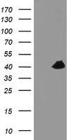 m06952 anti tbcc mouse monoclonal antibody clone id oti1g1 wb testing 1