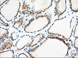 m06957 anti miox mouse monoclonal antibody clone id oti4g7 ihc testing 5