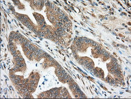m06957 anti miox mouse monoclonal antibody clone id oti4g7 ihc testing 9