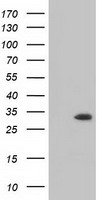 HEK293T cells were transfected with the pCMV6-ENTRY control (Left lane) or pCMV6-ENTRY MIOX (Right lane) cDNA for 48 hrs and lysed