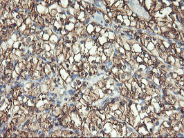 m06961 1 anti aminopeptidase a enpep mouse monoclonal antibody clone id oti1d4 ihc testing 6