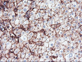 m06961 anti aminopeptidase a enpep mouse monoclonal antibody clone id oti4g8 ihc testing 10