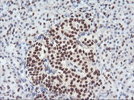m06961 anti aminopeptidase a enpep mouse monoclonal antibody clone id oti4g8 ihc testing 3