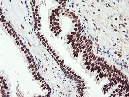 m06961 anti aminopeptidase a enpep mouse monoclonal antibody clone id oti4g8 ihc testing 7