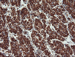 m06974 1 anti ubiquinol cytochrome c reductase core protein i uqcrc1 mouse monoclonal antibody clone id oti1g6 ihc testing 10