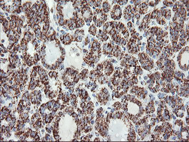 m06974 1 anti ubiquinol cytochrome c reductase core protein i uqcrc1 mouse monoclonal antibody clone id oti1g6 ihc testing 4