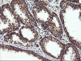 m06974 1 anti ubiquinol cytochrome c reductase core protein i uqcrc1 mouse monoclonal antibody clone id oti1g6 ihc testing 5