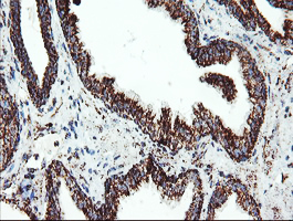 m06974 1 anti ubiquinol cytochrome c reductase core protein i uqcrc1 mouse monoclonal antibody clone id oti1g6 ihc testing 6