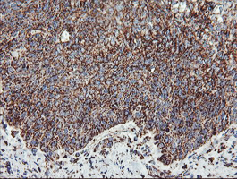 m06974 1 anti ubiquinol cytochrome c reductase core protein i uqcrc1 mouse monoclonal antibody clone id oti1g6 ihc testing 7
