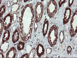 m06974 1 anti ubiquinol cytochrome c reductase core protein i uqcrc1 mouse monoclonal antibody clone id oti1g6 ihc testing 8