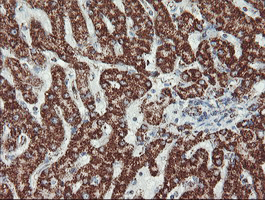 m06974 1 anti ubiquinol cytochrome c reductase core protein i uqcrc1 mouse monoclonal antibody clone id oti1g6 ihc testing 9