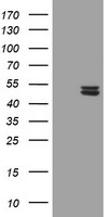 HEK293T cells were transfected with the pCMV6-ENTRY control (Left lane) or pCMV6-ENTRY UQCRC1 (Right lane) cDNA for 48 hrs and lysed